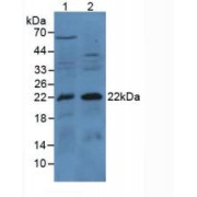 Western blot analysis of (1) Mouse Kidney Tissue and (2) Mouse Lung Tissue.