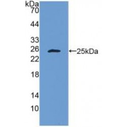 Bcl2 Associated X Protein (BAX) Antibody