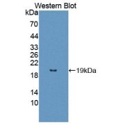 Western blot analysis of the recombinant protein.