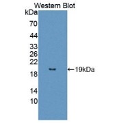 Western blot analysis of the recombinant protein.