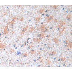 Tripartite Motif-Containing Protein 3 (TRIM3) Antibody