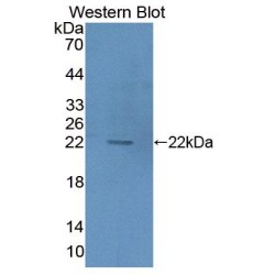 3-Hydroxyisobutyryl Coenzyme A Hydrolase (HIBCH) Antibody