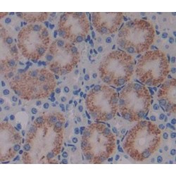 3-Hydroxyisobutyryl Coenzyme A Hydrolase (HIBCH) Antibody