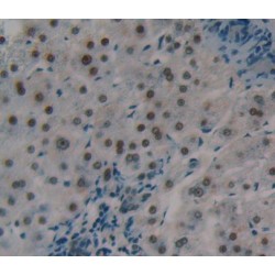 Lys-63-Specific Deubiquitinase BRCC36 (BRCC3) Antibody