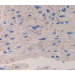 Calcium Channel, Voltage Dependent, T-Type, Alpha 1H Subunit (CACNa1H) Antibody