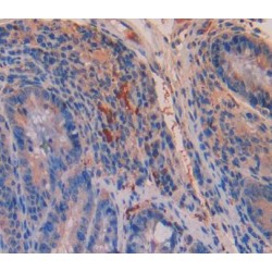 Trinucleotide Repeat Containing Protein 6A (TNRC6A) Antibody