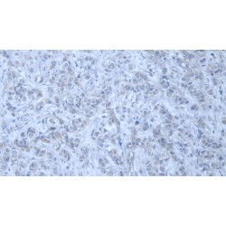 Trinucleotide Repeat Containing Protein 6A (TNRC6A) Antibody
