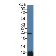 Western blot analysis of Human HeLa cell lysate, using Human CSN1 Antibody (1 µg/ml) and HRP-conjugated Goat Anti-Rabbit antibody (<a href="https://www.abbexa.com/index.php?route=product/search&amp;search=abx400043" target="_blank">abx400043</a>, 0.2 µg/ml).