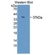 Western blot analysis of the recombinant protein.