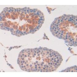 Carbonyl Reductase 1 (CBR1) Antibody