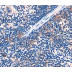 Dynein Heavy Chain Domain Containing Protein 1 (DNHD1) Antibody