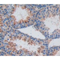 Receptor Interacting Serine Threonine Kinase 2 (RIPK2) Antibody