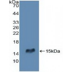 Receptor Interacting Serine Threonine Kinase 2 (RIPK2) Antibody