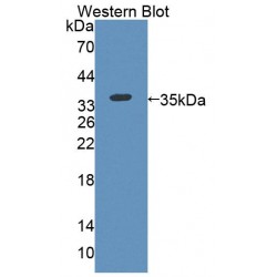 Kell Protein (KEL) Antibody