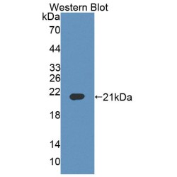 B- And T-Lymphocyte Attenuator (BTLA) Antibody