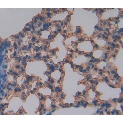 B- And T-Lymphocyte Attenuator (BTLA) Antibody