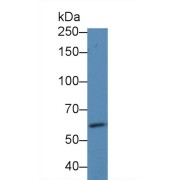 Western blot analysis of Human HeLa cell lysate, using Human EGFR2 Antibody (1 µg/ml) and HRP-conjugated Goat Anti-Rabbit antibody (<a href="https://www.abbexa.com/index.php?route=product/search&amp;search=abx400043" target="_blank">abx400043</a>, 0.2 µg/ml).