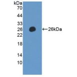 Leukocyte Immunoglobulin Like Receptor Subfamily B, Member 2 (LILRB2) Antibody