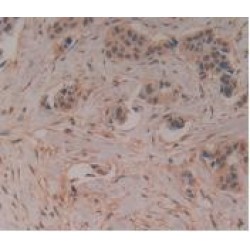 Leukocyte Immunoglobulin Like Receptor Subfamily B, Member 2 (LILRB2) Antibody