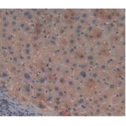 Leukocyte Immunoglobulin Like Receptor Subfamily B, Member 2 (LILRB2) Antibody