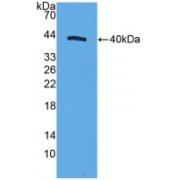 Western blot analysis of recombinant Human CD9/MRP1 Protein (with N-terminal His and GST tags).