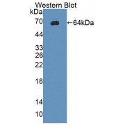 Western blot analysis of recombinant Rat gp130.