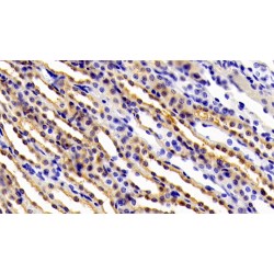Glycoprotein 130 (gp130) Antibody