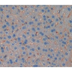 Broad Substrate Specificity ATP-Binding Cassette Transporter ABCG2 (ABCG2) Antibody