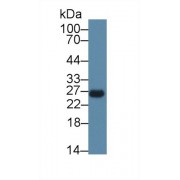 Western blot analysis of Rat Spleen lysate, using Mouse CEBPd Antibody (1 µg/ml) and HRP-conjugated Goat Anti-Rabbit antibody (<a href="https://www.abbexa.com/index.php?route=product/search&amp;search=abx400043" target="_blank">abx400043</a>, 0.2 µg/ml).