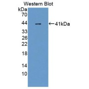 Western blot analysis of the recombinant protein.