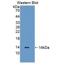 S100 Calcium Binding Protein A12 (S100A12) Antibody
