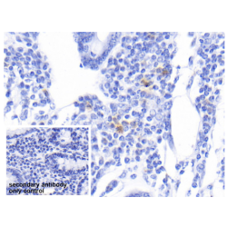 S100 Calcium Binding Protein A12 (S100A12) Antibody