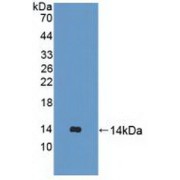 Western blot analysis of recombinant Human UBQLN2.