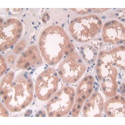 Ubiquilin 2 (UBQLN2) Antibody