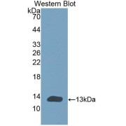 Western blot analysis of the recombinant protein.