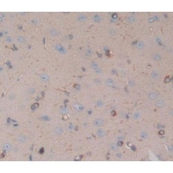 Cholinergic Receptor, Nicotinic, Alpha 10 (CHRNa10) Antibody
