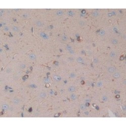 Cholinergic Receptor, Nicotinic, Alpha 10 (CHRNa10) Antibody