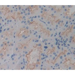 Cholinergic Receptor, Nicotinic, Alpha 3 (CHRNa3) Antibody