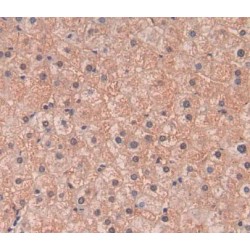 Cholinergic Receptor, Nicotinic, Alpha 4 (CHRNa4) Antibody