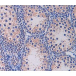 Cholinergic Receptor, Nicotinic, Epsilon (CHRNe) Antibody