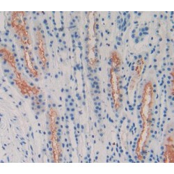 Latrophilin 2 (LPHN2) Antibody