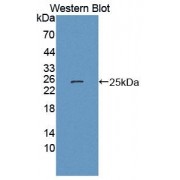 Western blot analysis of recombinant Mouse CISH.