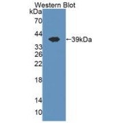 Western blot analysis of the recombinant protein.