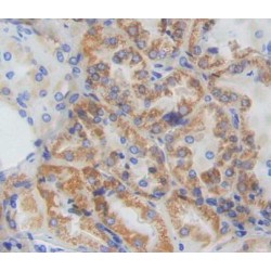 Cytokine Inducible SH2 Containing Protein (CISH) Antibody