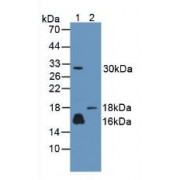 Western blot analysis of (1) Human A431 Cells and (2) Rat Skin Tissue.
