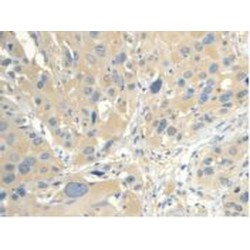 Calmodulin-Like Protein 3 (CAML3) Antibody