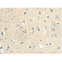 Calmodulin-Like Protein 3 (CAML3) Antibody