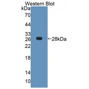 Western blot analysis of recombinant Human COL4a4 protein.