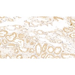 Collagen Type IV Alpha 4 (COL4A4) Antibody