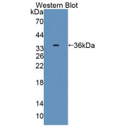 Western blot analysis of the recombinant Rat C8a protein